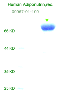 human adiponutrin recombinant