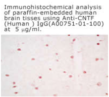 anti human CNTF antibody form immunohistochemistry