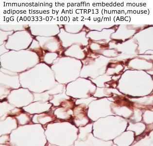 anti ctrp 13 antibody for immunohistochemistry from aviscera biooscience