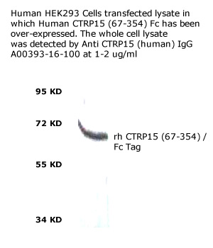 western blot analysis of CTRP15 on HEK293 cells transfected with human CTRP (67-354) cDNA
