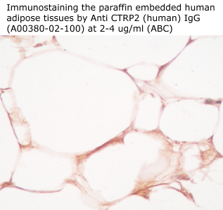 anti human ctrp2 antibody