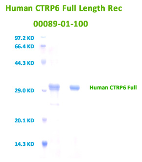 human ctrp6 full length