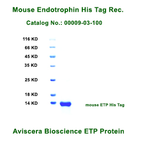 mouse Endotrophin His Tag Protein from Aviscera Bioscience