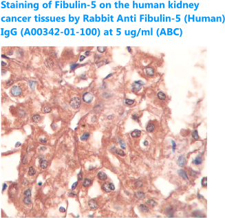 anti human fibulin-5 antibody for immunohistochemistry