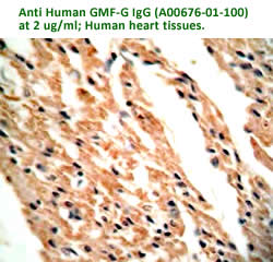anti human GMF-G antibody