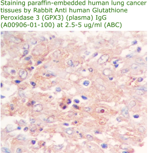 anti human plasma GPX3 antibody
