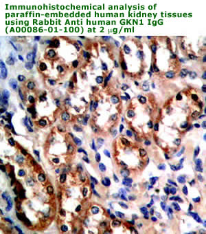 anti human gastrokine 1 antibody for IHC