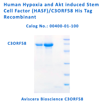 human C3ORF58 His Tag recombinant