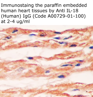 anti human IL-18 antibody from aviscera bioscience