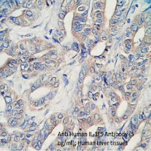 anti human IL-1F9 antibody from aviscera bioscience