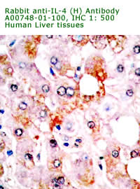 anti human IL-4 antibody form IHC