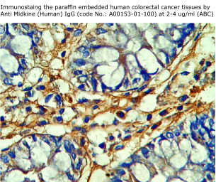 anti midkine antibody for immunohistochemistry