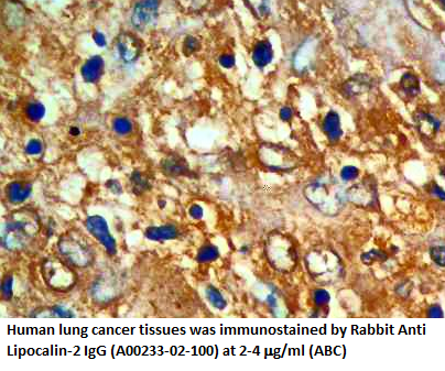 anti rat ngal antibody