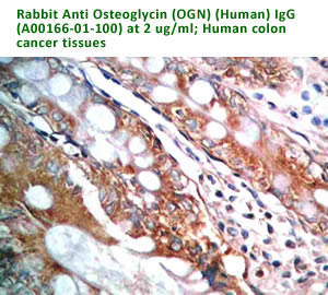 anti human osteoglycin antibody A00166-01-100 for immunohistochemistry