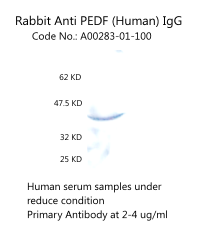 anti PEDF antibody enables to detect PEDF on human serum samples aviscera bioscience