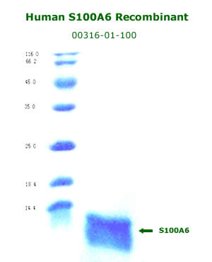 human S100A6 recombinant
