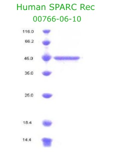 human sparc recombinant from aviscera bioscience