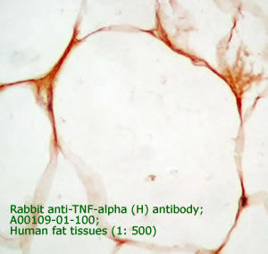 anti TNF antibody