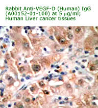anti vegf-d antibody