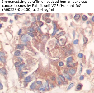 anti human VGF antibody from aviscersa bioscience