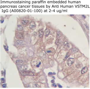 anti human VSTM2L antibody from aviscera bioscience