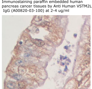 anti human VSTM2L antibody from aviscera bioscience