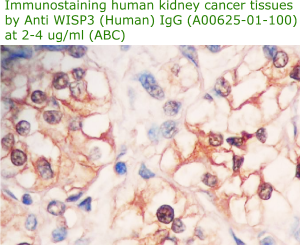 anti wisp3 antibody