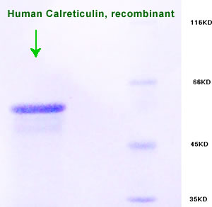 human calreticulin recombinant