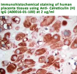 anti calreticulin antibody A00016-01-100