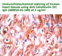 anti calreticulin antibody A00016-01-100 is available in stock