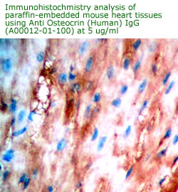 anti human osteocrin antibody for immunohistochemistry