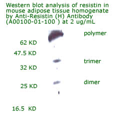 anti human resistin antibody from aviscera bioscience