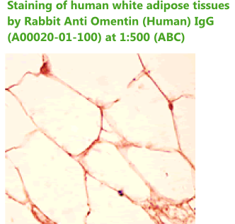 anti omentin antibody
