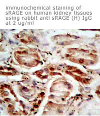 anti sRAGE antibody